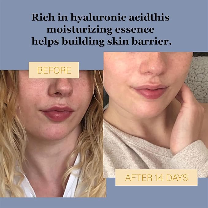 Hyaluronic Acid Face Essence Spray, Fast Absorption Replenish Water Shrink Pore, Moisturizing Soften Skin Texture, Reduce Wrinkle Improving Skin Vitality; 100ml/3.38 fl.oz (Hyaluronic Acid)