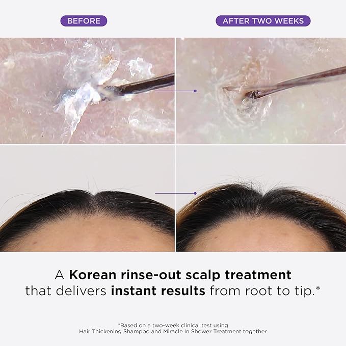Dr. Groot Miracle in Shower Treatment for Hair Loss, Korean Hair Care, 5 Seconds to Smooth Hair, Rosemary Oil for Healthier-Looking Hair, Hair Rinse, Moisturizing Treatment,Scalp Revitalizing Solution