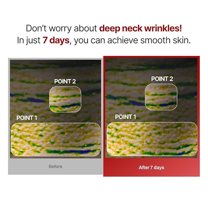 Wrinkle-fit Neck Mask 7EA + Boosting Roller - Neck Wrinkle Patches, Firming and Tightening Korean Deep Collagen Mask - NeckTargeted Mesh Sheet Mask and Face Roller for Lifting Sagging Skin