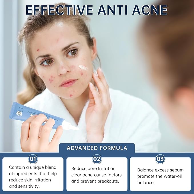 14% Azelaic Acid Acne Cream, Azelaic Acid Serum with Hyaluronic Acid, Niacinamide & Squalane, Reduce Acne, Pore Refining & Oil Control, Face Moisturizer for All Skin Types, 30ML