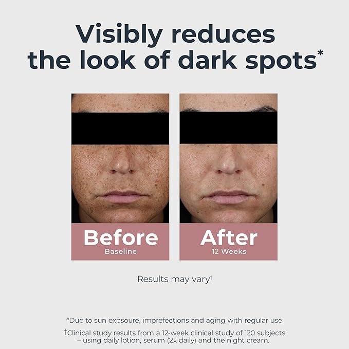 Eucerin Radiant Tone Night Cream, Dark Spot Corrector for Face with Thiamidol, Helps Visibly Reduce the Look of Persistent Dark Spots, 1.7 Oz Bottle