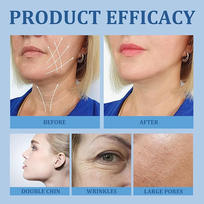 Chinology Chin Mask Double Chin, Reusable Chinology Chin Lifting Mask, Lifting Face with Collagen, Say Goodbye To Your Double Chin Now (2PCS)