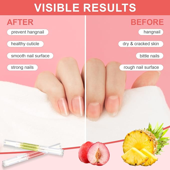 Meschett 3PCS Nail Cuticle Oil Pens with Nail File, Cuticle Oil for Nails from Natural, Nail Oil Cuticle for Cracked and Dry Nail(Pineapple & Peach & Jasmine Flavor)