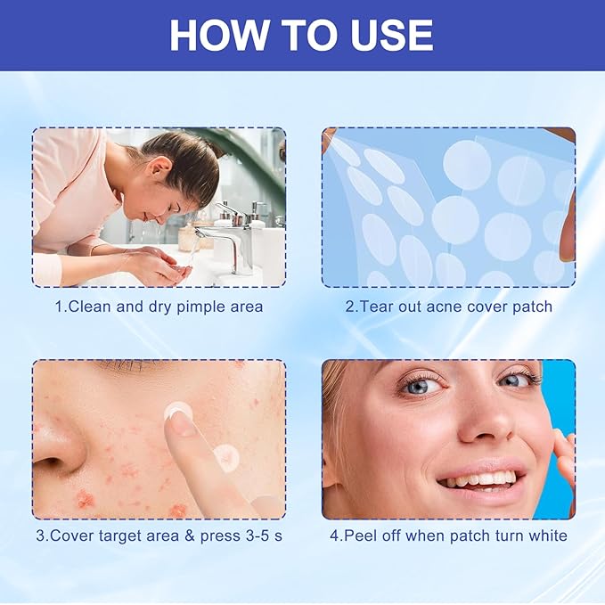 Pimple Patches for Face, 288 Hydrocolloid Acne Patches, Cute Round Shape Zit Covers, Patches for Covering Zits, Colorful Spot Stickers with Tea Tree, Salicylic Acid & Cica Oil