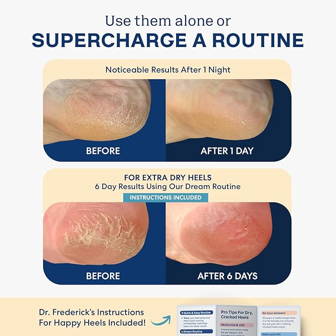 Dr. Frederick's Original Moisturizing Fuzzy Heel Socks - 2 Pairs - Cozy Gel-Lined Sleep Socks for Women & Men - Soothes Dry, Cracked Feet - Heel Repair - Variety Pack