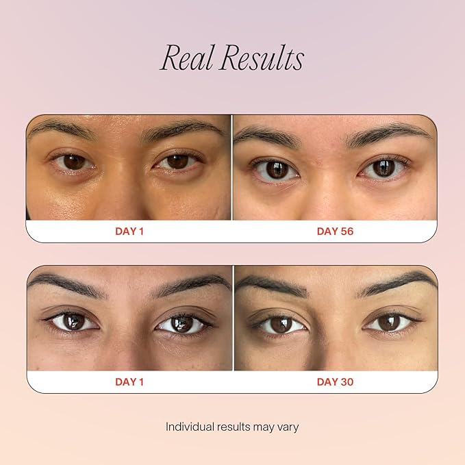 Solawave Eye Recovery Pro Kit | Red Light Therapy Eye Mask + LightBoost Eye Cream | Reduce Fine Lines & Wrinkles, Under Eye Dark Circles, & Puffiness