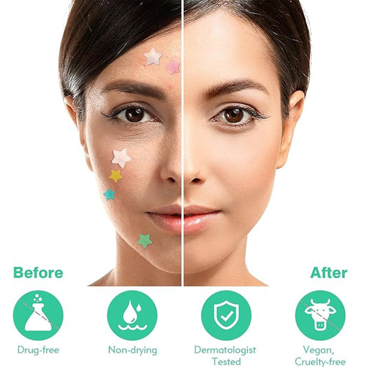 Pimple Patches For Face 240 Counts Hydrocolloid Acne Patches Colorful Zit Patches Acne Dots Blemish Patches with Salicylic Acid Tea Tree Oil Calendula Oil 3 Sizes Acne Patches Star Pimple Patches