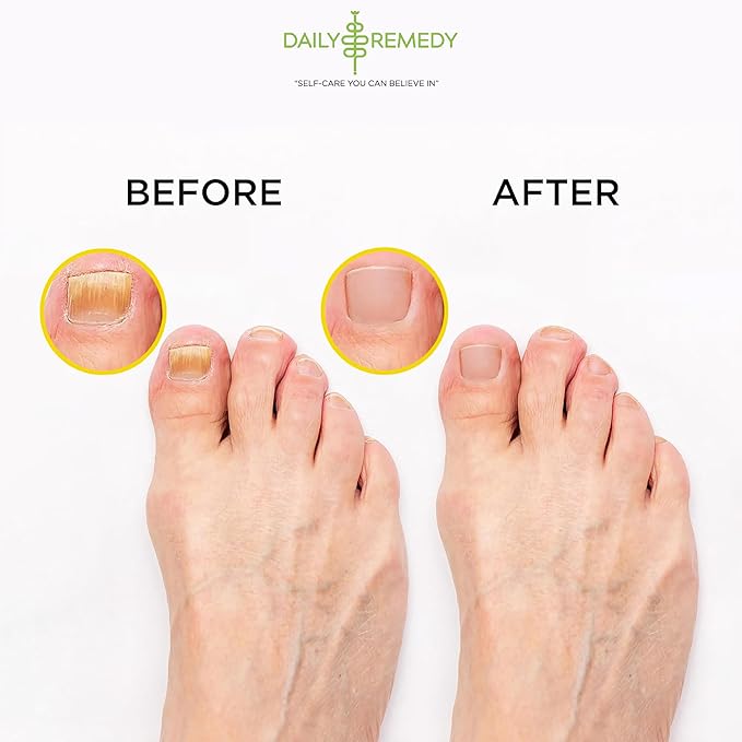 Citrus Detox Foot Soak with Epsom Salt - for Foot Callus, Immune Boost, Damaged Toenail, Athletes Foot, Pedicure and Soothes Tired Feet - Made in USA