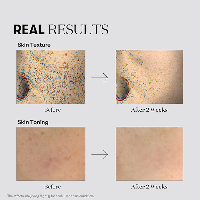 VT COSMETICS TX Toning Daily Mask 30 Sheets, Tranexamic Acid, Niacinamide, Glutathione for Acne Scars, Dark Spots, Hydrating & Glowing Facial Mask, Fragrance-Free, Korean Face Mask