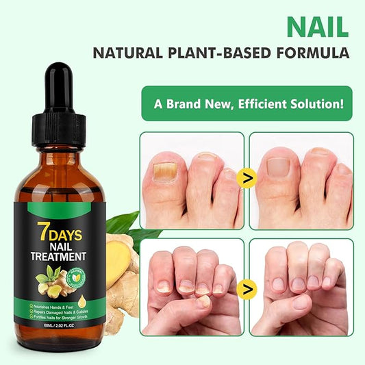 Ginger Nail Serum,Nail Growth Serum, Ginger Cuticle Care Oil for Strengthen Nails & Promote Nail Growth, Natural Plant Formula 2 Fl.oz