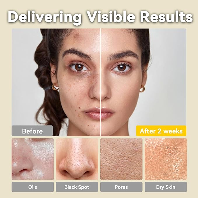 Turmeric Clay Mask, Green Tea, Dead Sea Minerals Mud Mask, Spa Facial Mask 3-Piece Set for Deep Cleansing, Moisturizing, and Refining Pores, Vegan & Cruelty-Free 2.5 oz each