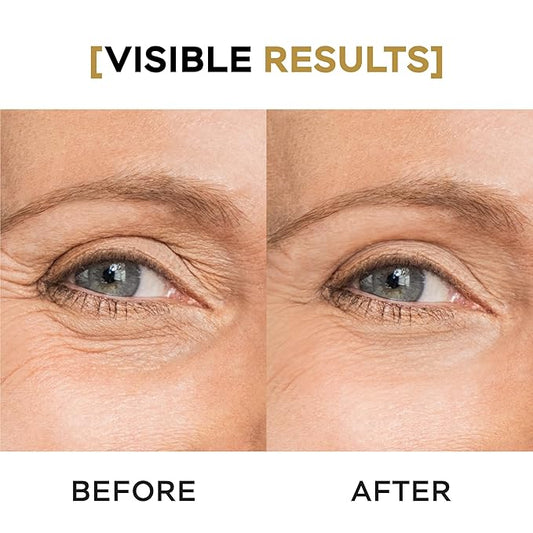 Moisturizing Eye Cream w/Aloe Vera, Collagen, Hyaluronic Acid, Cotton Stem Cells for Dark Circles, Puffiness & Bags - Under Eye Hydration Cream for Women & Men (1 Fl Oz)