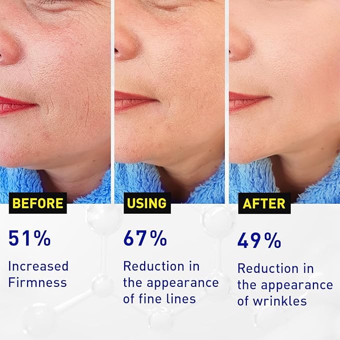 Super C Serum for Face: Enaskin Naturals Vitamin C Face Serum with Ferulic Acid for Women Mature Skin, Premium Formula Vit C Facial Serum for Brightening Dark Spots and Glowing up Skin - 1.7 Oz