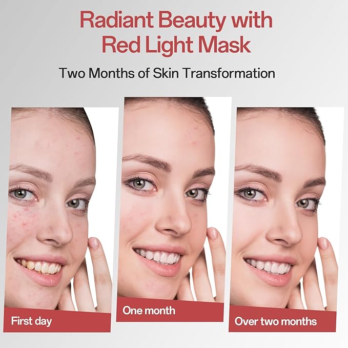 Red Light Mask - 7 Colors Red Light Mask for Face, Facial Skin Care Device with Remote Control, Ergonomic Design and Portable for Home