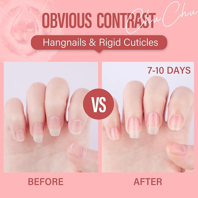 CHUCHU Cuticle Oil for Nails: Rose Jojoba Nail Cuticle Oil for Repair and Strengthening Nails - Vitamin B & E Moisturizes Cuticle and Nail's Skin - Prevents Hangnails and Chapped 15ML