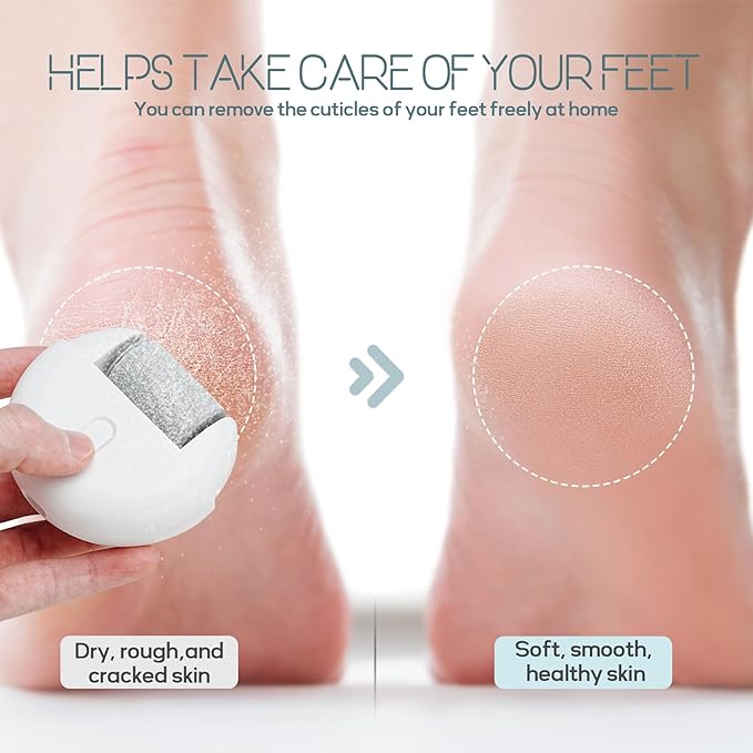 Automatic Callus Remover for Feet, Rechargeable Pedicure Tools for Feet, Electric Foot Callus Remover with 3 Roller Heads 2 Speed, Waterproof Foot File Perfect for Dead Hard Cracked Dry Skin