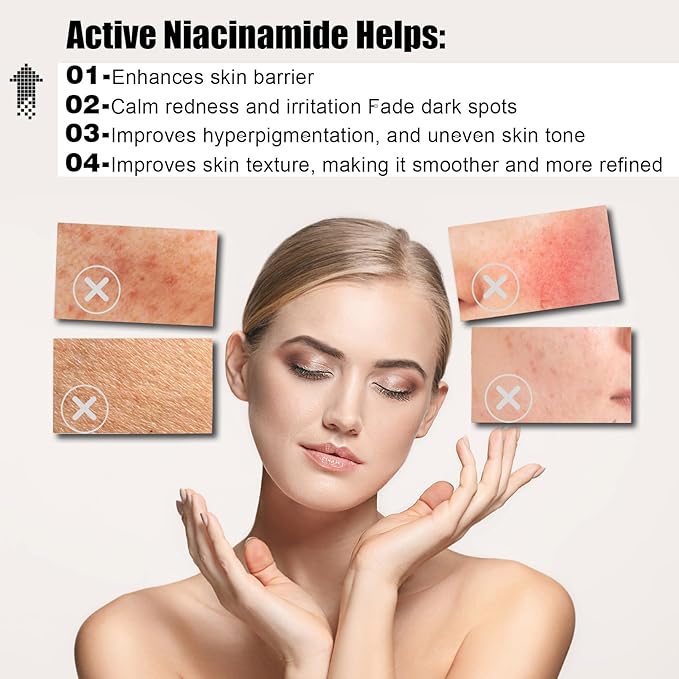 [Upgraded] Dark Spot Remover for Face, Dark Spot Correcting Glow Serum with Niacinamide Retinol and Vitamin C, Rapid Skin Brown Spot Remover, Sun Spot Age Spot Corrector for Daily Skincare 1FL,OZ/30ML