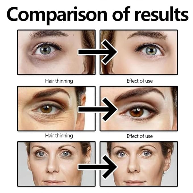 Kubot Instant Lift Eye Cream,Effective Instant Eye Lift,Multi Effect Firming and Tightening Under EyeCream,Under Eye Cream for Puffy Eye Bags Fine Lines