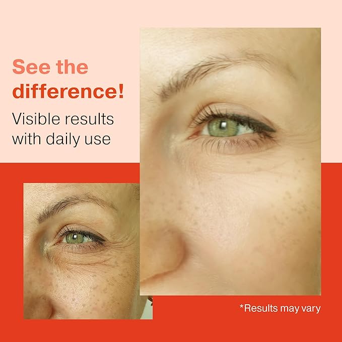 Retinol Serum for Face 2OZ + Vitamin C Face Serum 2OZ