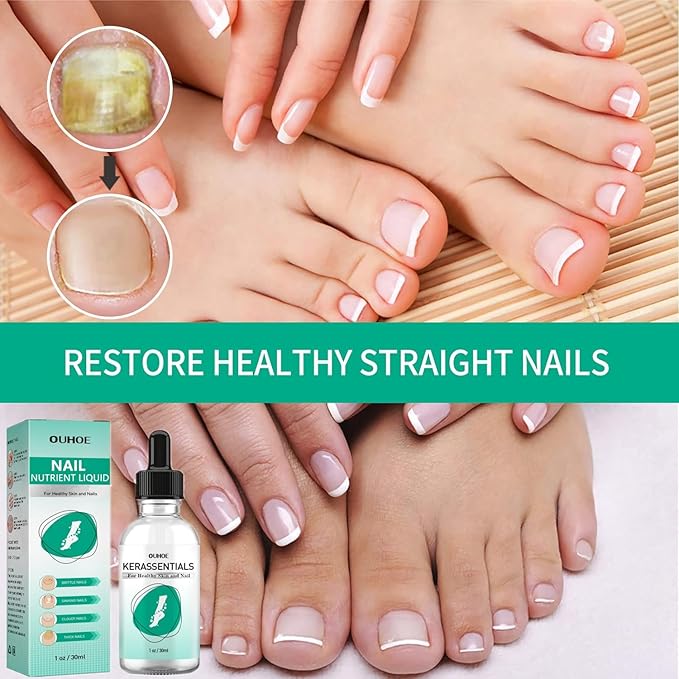 Kerassentials Toenail Oil, Kerassentials Nails colourless (3PCS)