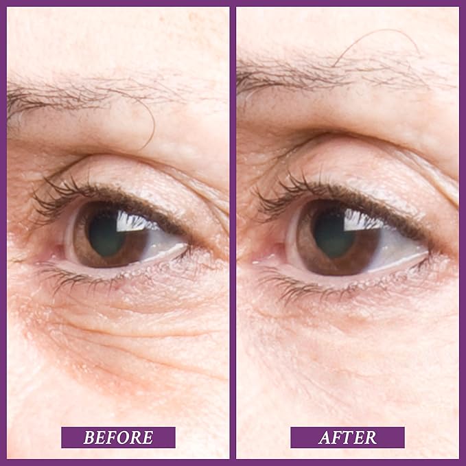 PRAI Beauty Ageless Eye Tight Uplift Serum, Anti-Aging and Hydrating Eye Serum, For Instantly Ageless Brow and Eyelid Area, 0.5 Oz