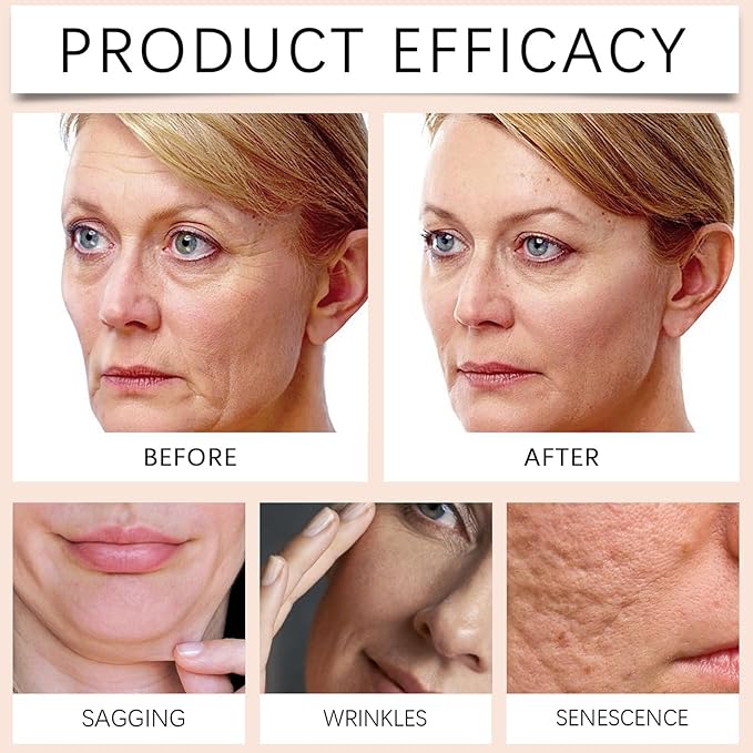 Bee Venom Firming Serum Stick - 30g Bee Venom Body Tightening Cream for Men & Women | Hydrating, Lifting & Restoring Skin Elasticity | Natural Formula for All Skin Types