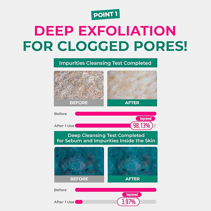 BRING GREEN X NETFLIX SQUID GAME Edition Tea Tree Cica Pore Clay Pack Strong 100g