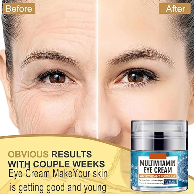 Eye Cream for Women, Multivitamin Eye Cream Under Eye Cream for Dark Circles Anti Aging and Wrinkle Deeply Moisturizing Reduces Bags Puffiness Face Tightening Eye Lift 1.7oz