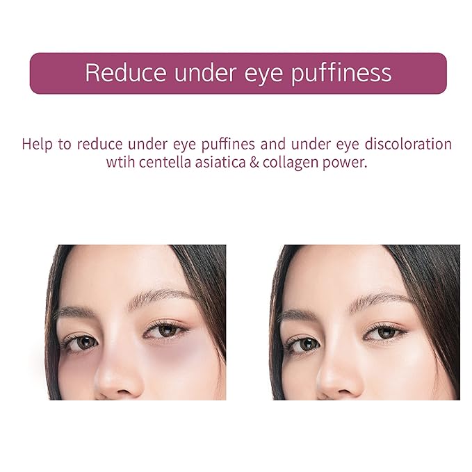 Powerful Collagen Eye Patches - 5 Pairs - Puffy Eyes and Dark Circles Treatments | Reduce Wrinkles Undereye, Revitalize and Refresh Your Skin(1Pack)
