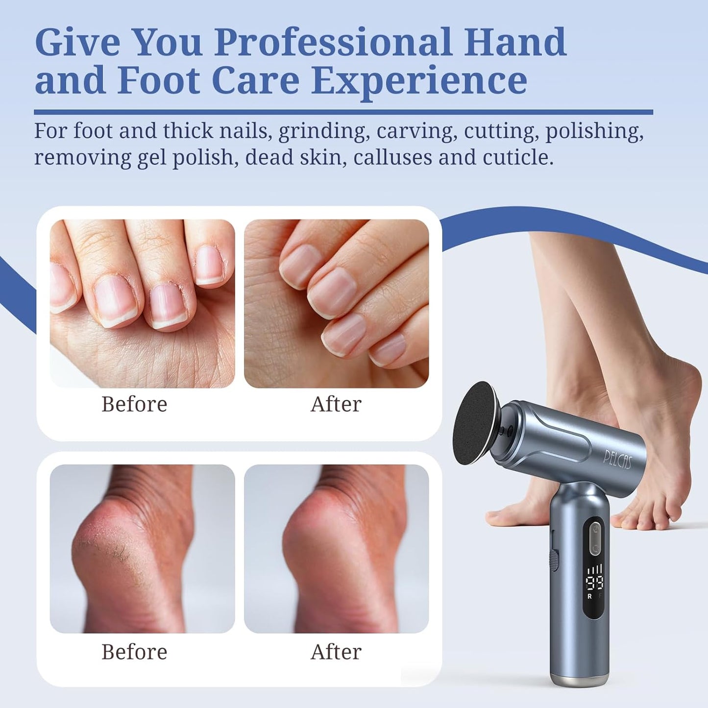 PELCAS Electric Foot Callus Remover with LED Screen, Upgraded Electric Foot File, 2 in 1 Manicure & Pedicure Kit for Women & Men, Cordless Feet Filer for Foot Callus, Thick Nails, Finger Nails Grey