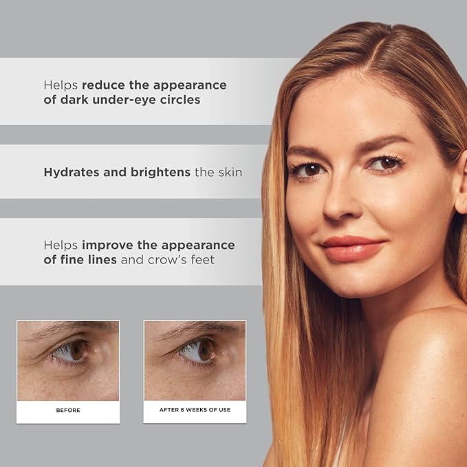 Glytone Age-Defying PHA+ Renewing Eye Cream for Wrinkles| Anti aging Under Eye Cream with Hyaluronic Acid Peptides| Targets Puffiness, Bags, Wrinkles & Dark Circles| Brightening Moisturizer| 0.5 Fl oz