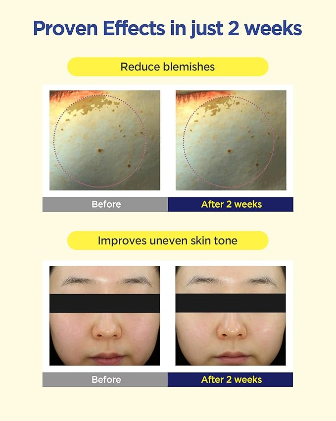 CKD Vita C Teca Blemish Shot Mask - Hydrogel Firming Face Mask Sheet with Pure Vitamin C & Centella Asiatica, Radiance, Relief for Dark Spots & Blemishes, 5 sheets