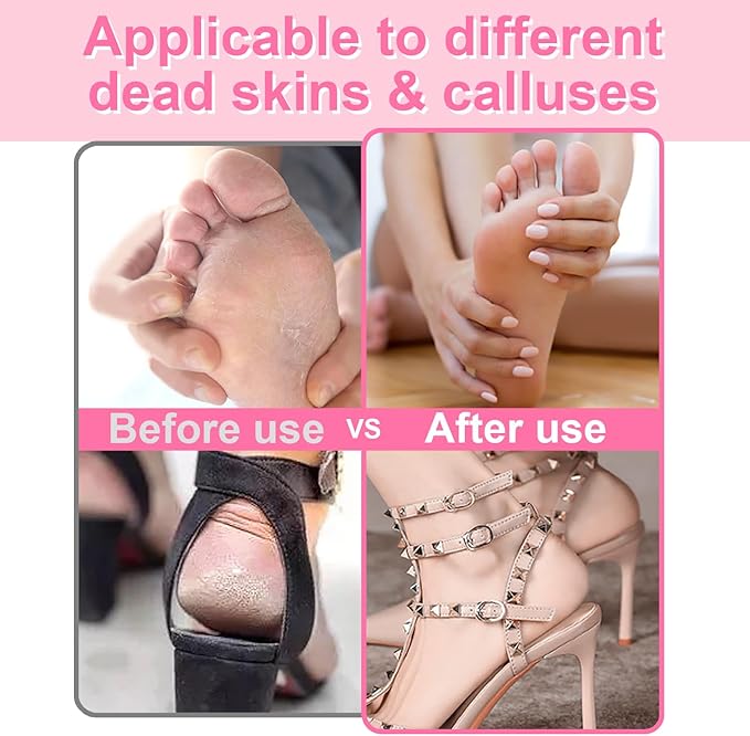 Electric Foot File - Callus Remover for Feet,Adjustable Speed Foot Scrubber with 60 Pcs Sandpaper Discs,Professional Pedicure Tool for Dead Skin and Calluses - Matte Purple