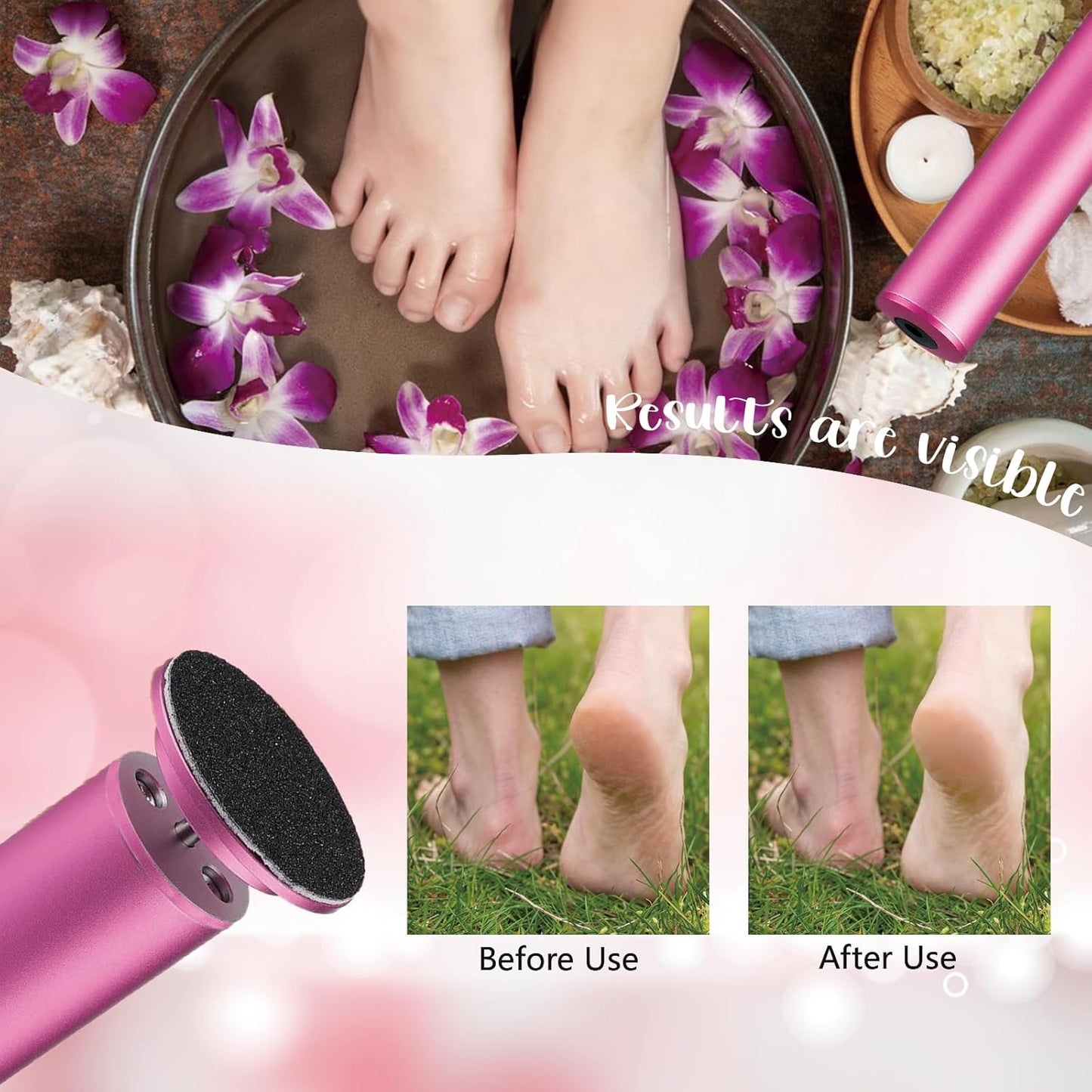 Dermave Upgraded Electric Callus Remover for Feet,Electric Foot File Feet Sander ,Adjustable Speed Foot Scrubber,Women Men Dead Skin and Cracked Professional Pedicure Tool,60Pcs Sandpaper Discs