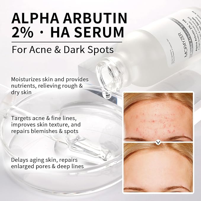 Alpha Arbutin 2% + HA Serum for Anti Aging & Wrinkles, 1 PCS Moisturizing Alpha Arbutin Serum 2% with Hyaluronic Acid, Niacinamide for Acne & Spots, Hyaluronic Acid Essence for Face.