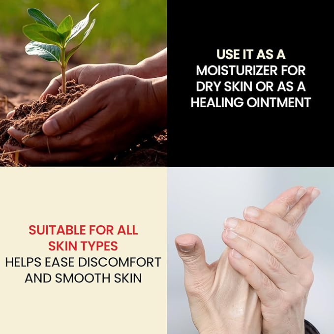 Dr. Hess' 1893 Original Udder Ointment, All-Purpose Nourishing Body Moisturizer for Healing Dry, Irritated Skin, Cracked Heels, Rashes, Chafing with Lanolin, Beeswax, & Eucalyptus Oil, 1.4 oz 4 Pack