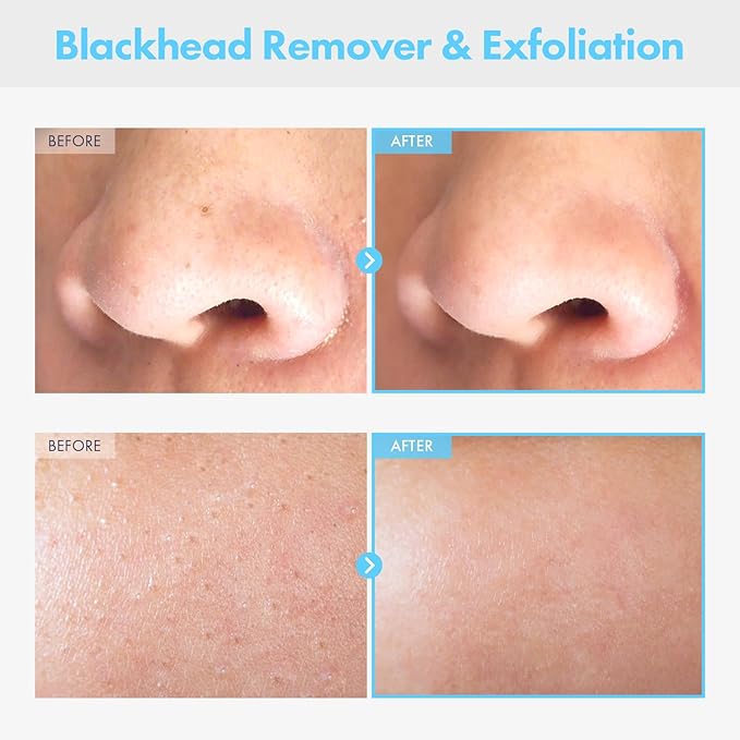 Pure Deep Cleansing Oil with AHA+PHA, Argan, Jojoba Oil, Centella Asiatica, Blackhead Remover, Oil Based Cleanser for Face, Sebum Control, Pore Cleaner, kbeauty Skincare, 145ml, 4.9 fl. oz.