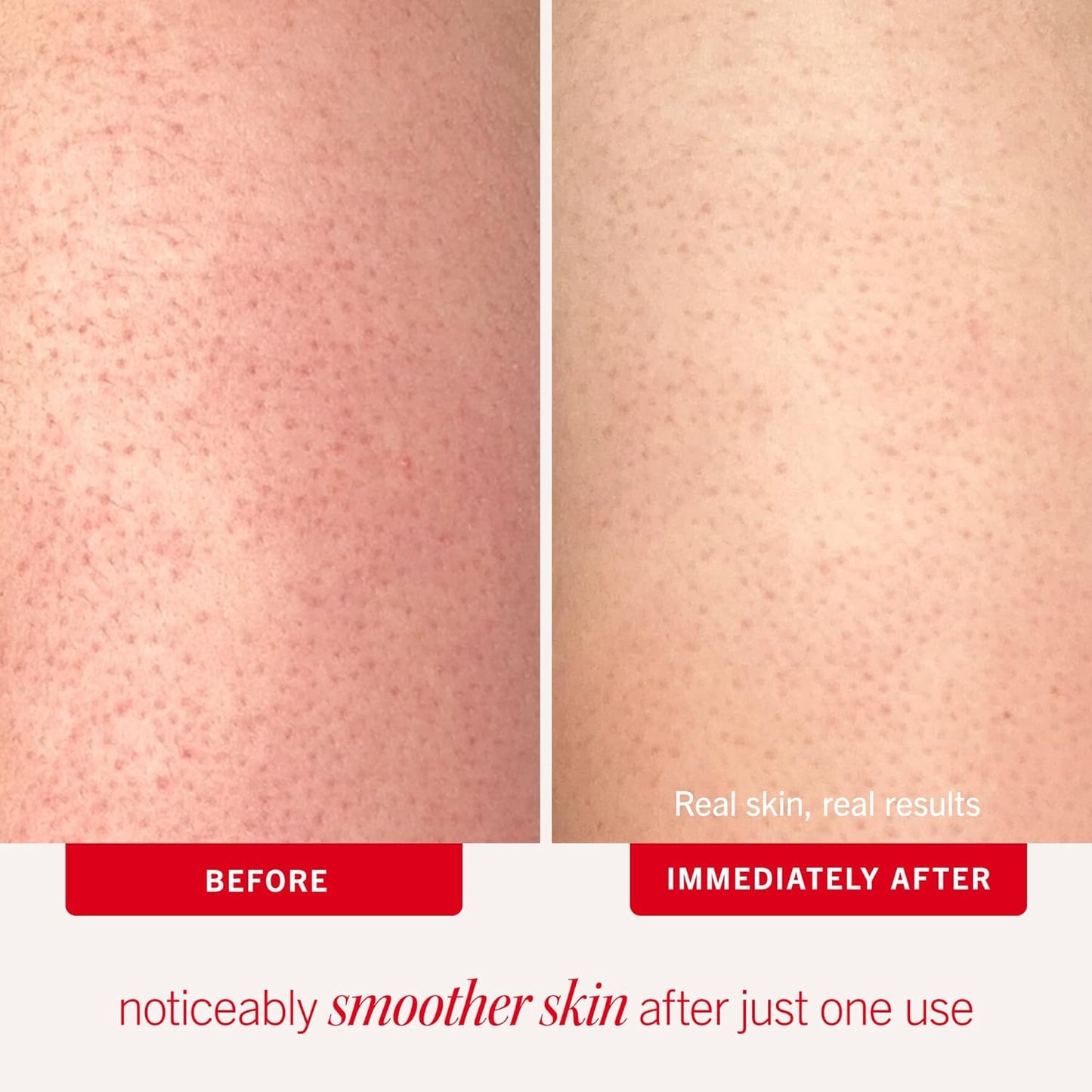 First Aid Beauty Smooth + Juicy Body Scrub Kit: KP Bump Eraser Body Scrub with 10% AHA, Daily Exfoliation Keratosis Pilaris Set to Help Reduce Chicken Skin Bumps; Strawberry, Peach, & Original (2 oz)