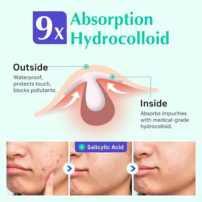 XXL Acne Patches - Hydrocolloid Pimple Covers for Face & Body Breakouts | Cystic Zit Treatment | Vegan (12ct)