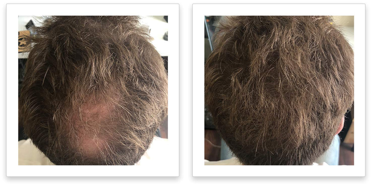 FEBRON Hair Fibers For Thinning Hair For Women & Men Hair Loss Concealer Hair Powder Volumizing Based 100% Undetectable & Natural - Bald Spots Filler (30 Gram, Light COOL Brown)