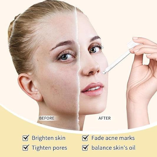 Niacinamide 10% + Zinc 1% Face Serum For Women,Niacinamide Hydrating Serum with Hyaluronic Acid for Oil Control & Anti Acne, 30 ml Anti Aging Niacinamide Serum for Skin Barrier Repair,2Pcs