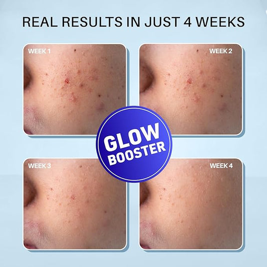 Night Cream (50g) | With Niacinamide & Alpha Arbutin | Face Moisturizer | 1.76 Oz