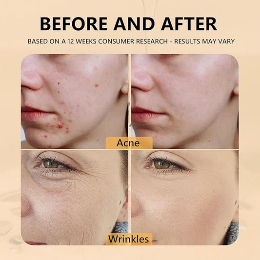 Snail Mucin Face Serum 97% rejuvenating benefits of Snail Mucin,deeply hydrates and moisturizes, Experience skin that adapts seamlessly to diverse climates.Improve dull skin and fine lines.