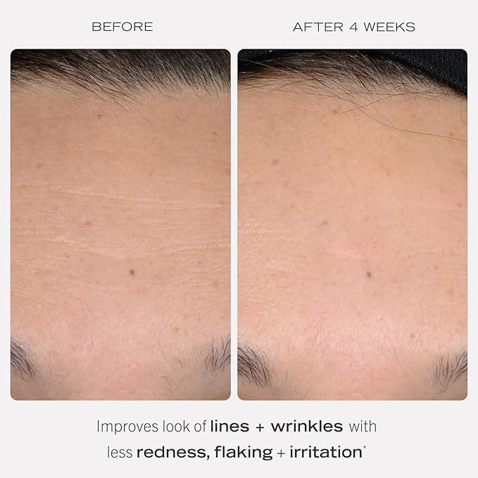 First Aid Beauty - Retinol Bundle: 0.3% Retinol Complex Serum with Peptides, 1 oz, & Retinol Eye Cream with Squalane + Ceramides, 0.5 oz, Improves Look of Lines & Wrinkles with Less Irritation, 2ct