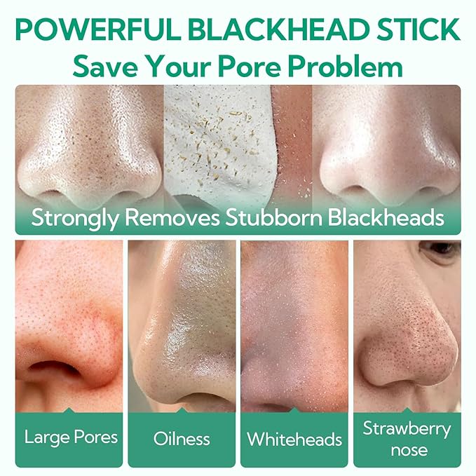 BREYLEE Blackhead Remover Mask, Tea Tree Oil Nose Pore Strips +100 papers, Puntos Negros, Peel Off Mask for Nose and Face, Pore Cleanser Purifying, Brush Desigh