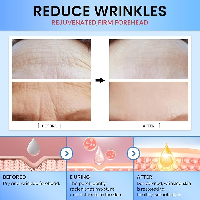 Forehead Wrinkle Patches 20 PCS, Anti Wrinkle Patches With Collagen, Vitamin, Forehead Wrinkles Treatment For Smoothing & Softening Fine Lines (transparent)