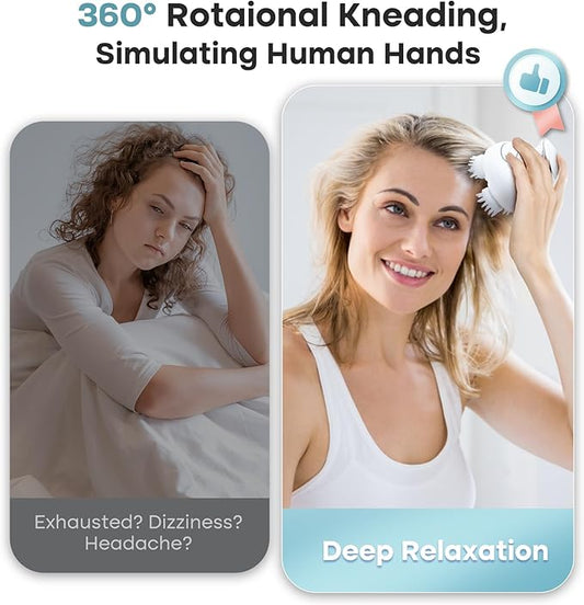 arboleaf Scalp Massager Electric Gripping Head Massager Scalp Stress Relax Portable Rechargeable Hair Massage Waterproof Cat Massage Tool, Gift for Mom