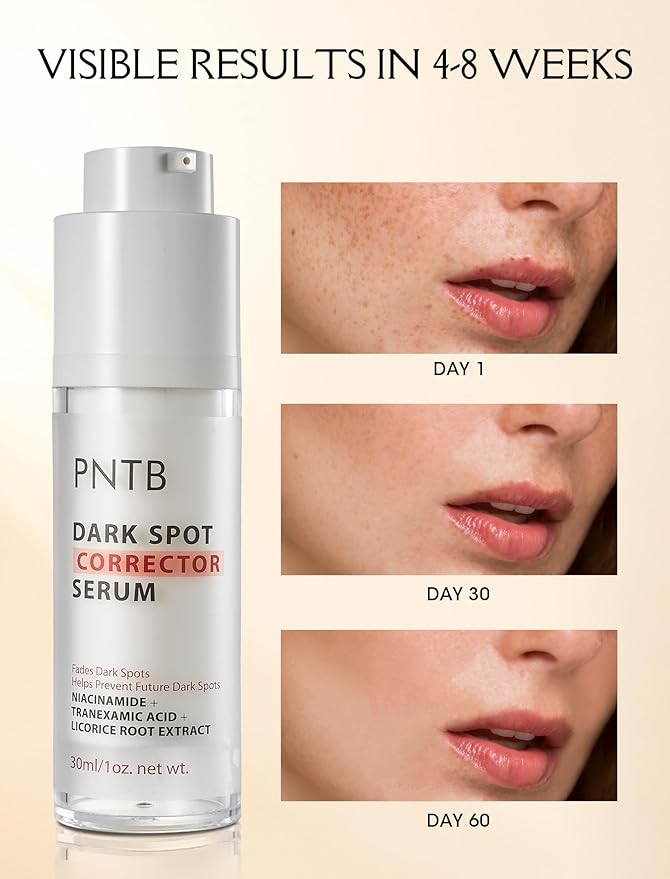 Dark Spot Remover for Face and Body, Dark Spot Corrector Glow Serum, Skin Brown Spot Remover, Skin Care Face Cream, Sun Spot Remover, Age Spot Corrector, Rapid Tone Repair 1oz