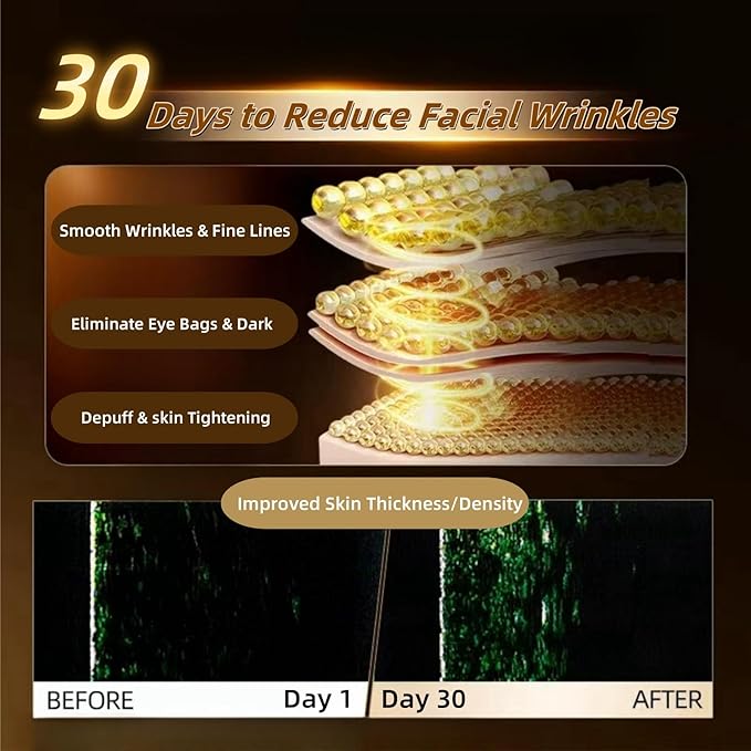 Skin Firming Facial Device, Professional Home Beauty Device for Face and Body, 5 Energy Levels - Salon Results