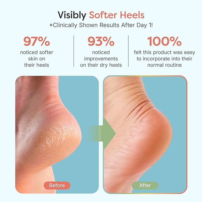 ZenToes Moisturizing Socks for Cracked Heel Treatment - Vitamin E, Olive Oil and Jojoba Oil Infused Heel Socks to Soften and Hydrate (Fuzzy Blue, Regular)